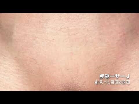 白虎 陰部